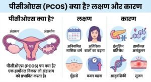 PCOS symptoms causes in Hindi